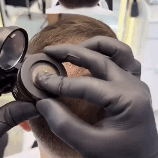 Hair Fill™ | Polvos de Densidad Capilar